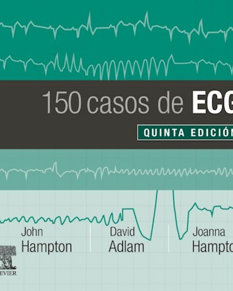 150 PROBLEMAS DE ECG 5ED.