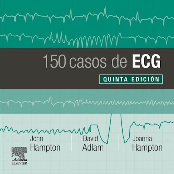 150 PROBLEMAS DE ECG 5ED.