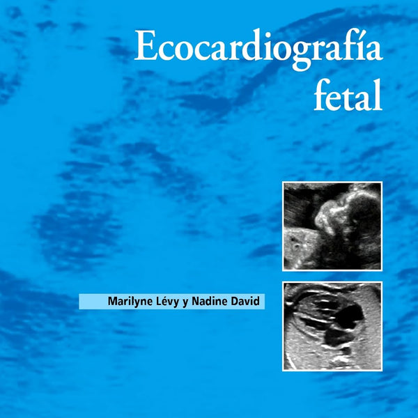 ECOCARDIOGRAFIA FETAL