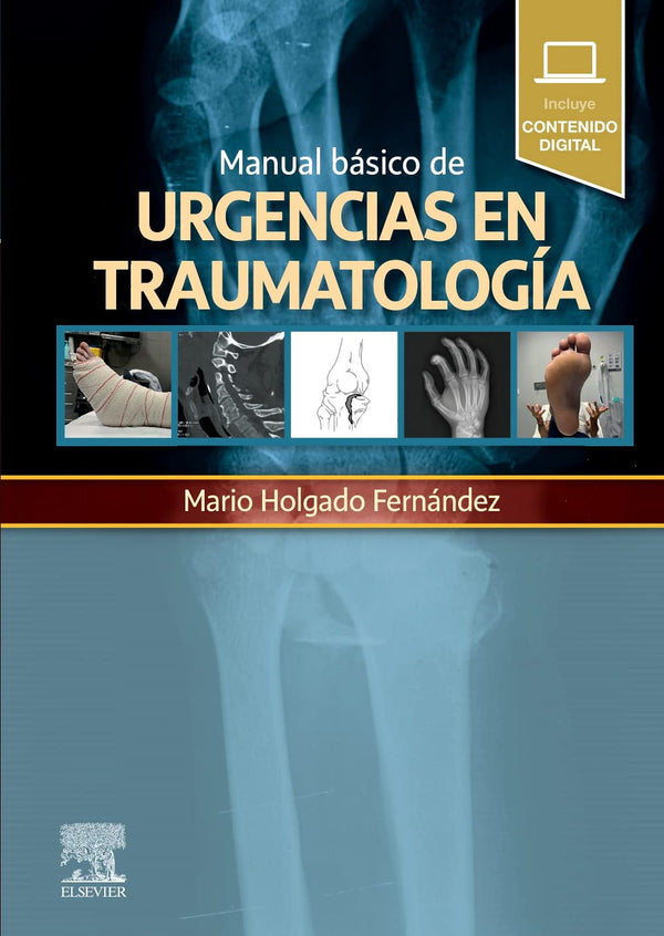 MANUAL BÁSICO DE URGENCIAS EN TRAUMATOLOGIA