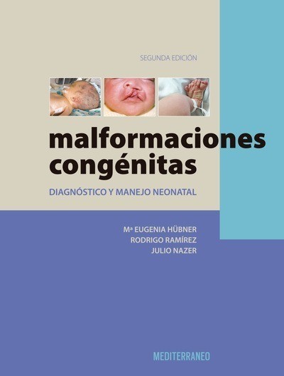 MALFORMACIONES CONGENITAS 2ED.